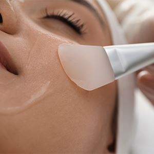 Chemical Peels