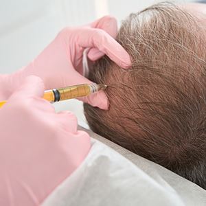 Hair Restoration Therapy